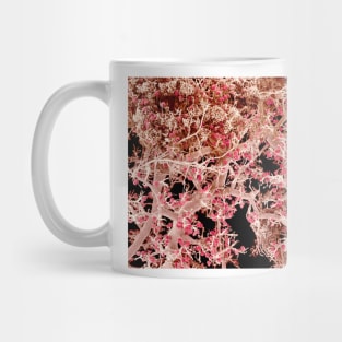 Kidney blood vessels, SEM (C022/7915) Mug